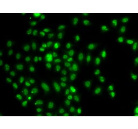 Immunofluorescence - Anti-FOXN2 Antibody (A92171) - Antibodies.com