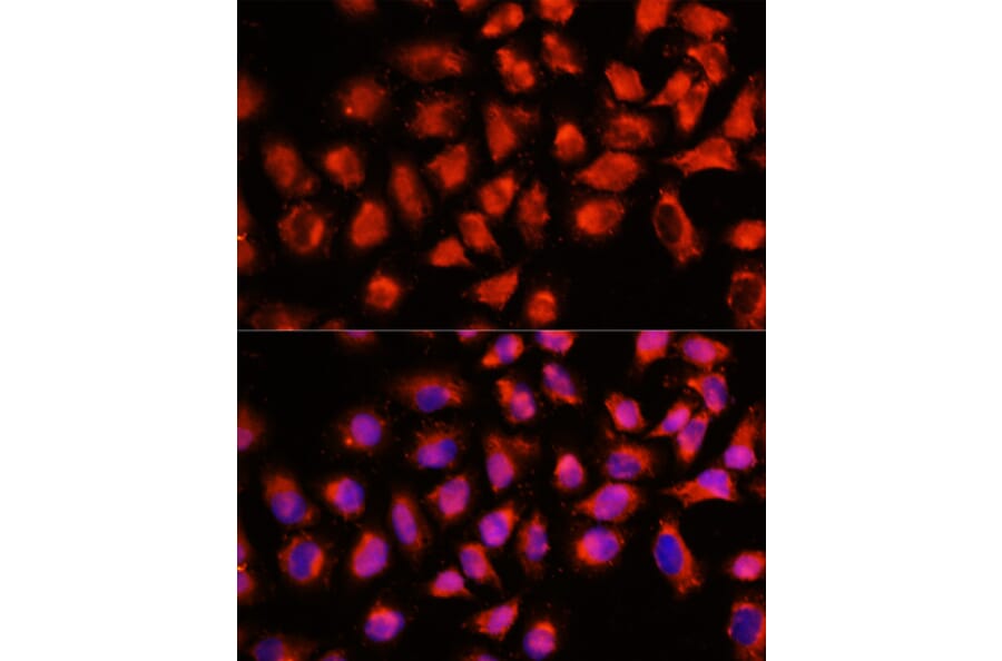 Immunofluorescence - Anti-ADAM8 Antibody (A15022) - Antibodies.com