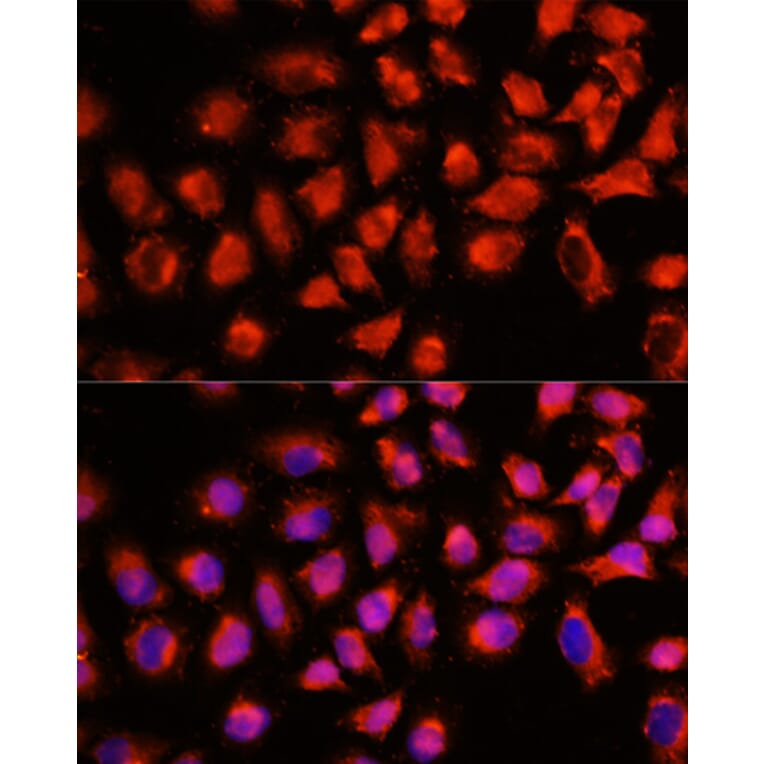 Immunofluorescence - Anti-ADAM8 Antibody (A15022) - Antibodies.com