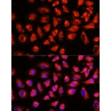 Immunofluorescence - Anti-ADAM8 Antibody (A15022) - Antibodies.com