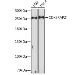 Western Blot - Anti-CDK5RAP2 Antibody (A92174) - Antibodies.com