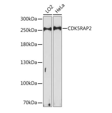 Western Blot - Anti-CDK5RAP2 Antibody (A92174) - Antibodies.com