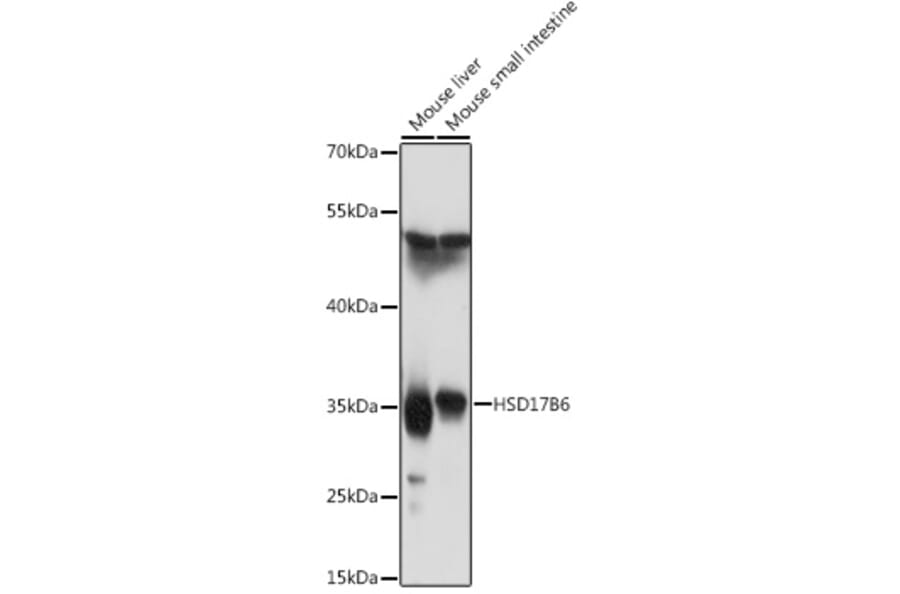 Western Blot - Anti-HSD17B6 Antibody (A92175) - Antibodies.com