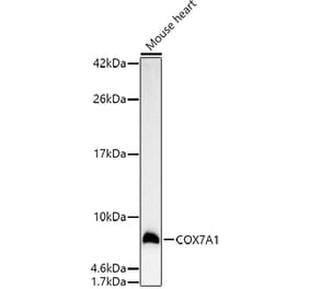 Western Blot - Anti-Complex IV Antibody (A92177) - Antibodies.com
