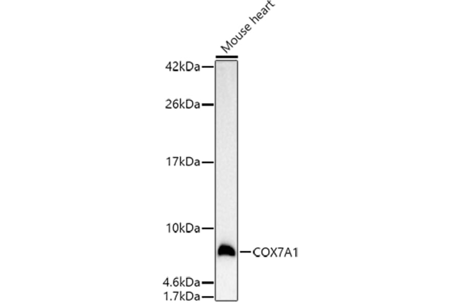Western Blot - Anti-Complex IV Antibody (A92177) - Antibodies.com