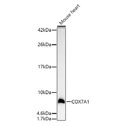 Western Blot - Anti-Complex IV Antibody (A92177) - Antibodies.com