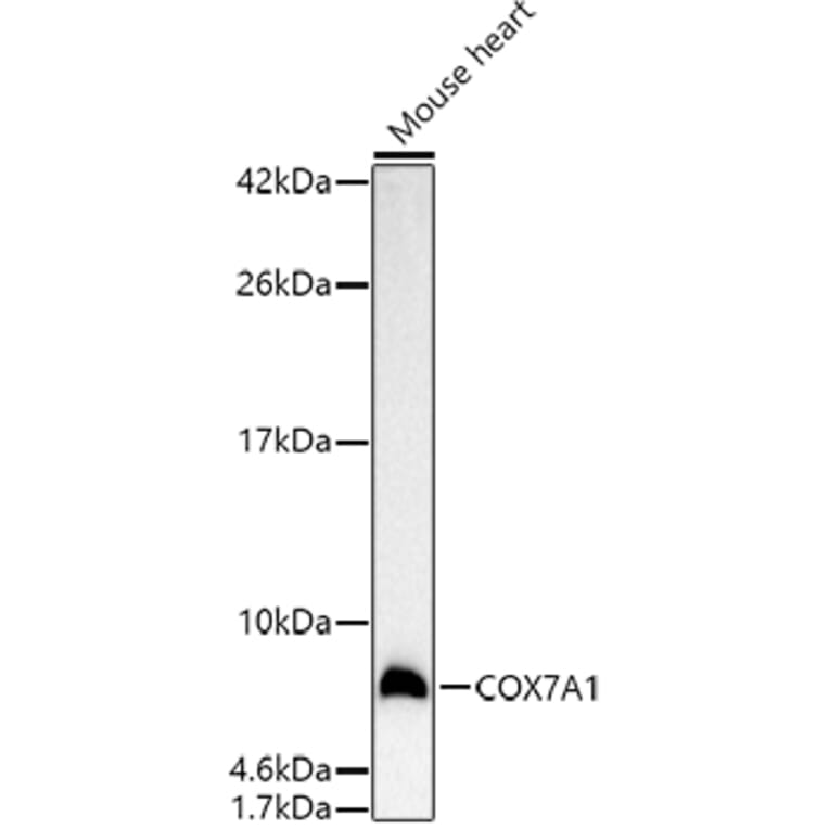 Western Blot - Anti-Complex IV Antibody (A92177) - Antibodies.com