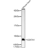 Western Blot - Anti-Complex IV Antibody (A92177) - Antibodies.com