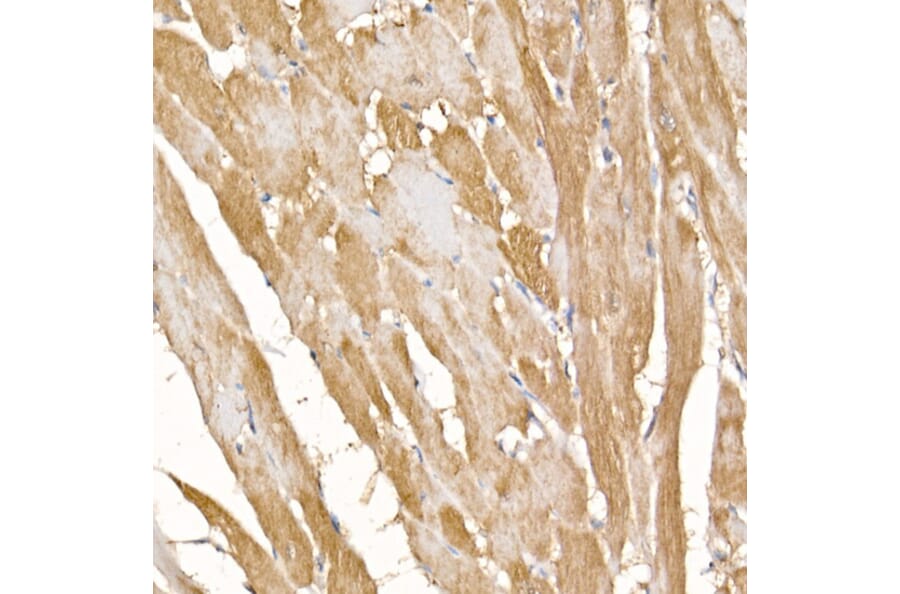 Immunohistochemistry - Anti-Complex IV Antibody (A92177) - Antibodies.com