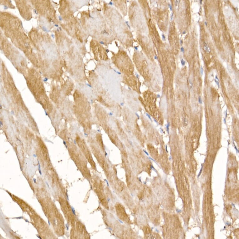 Immunohistochemistry - Anti-Complex IV Antibody (A92177) - Antibodies.com