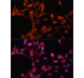 Immunofluorescence - Anti-SLC25A19 Antibody (A92178) - Antibodies.com