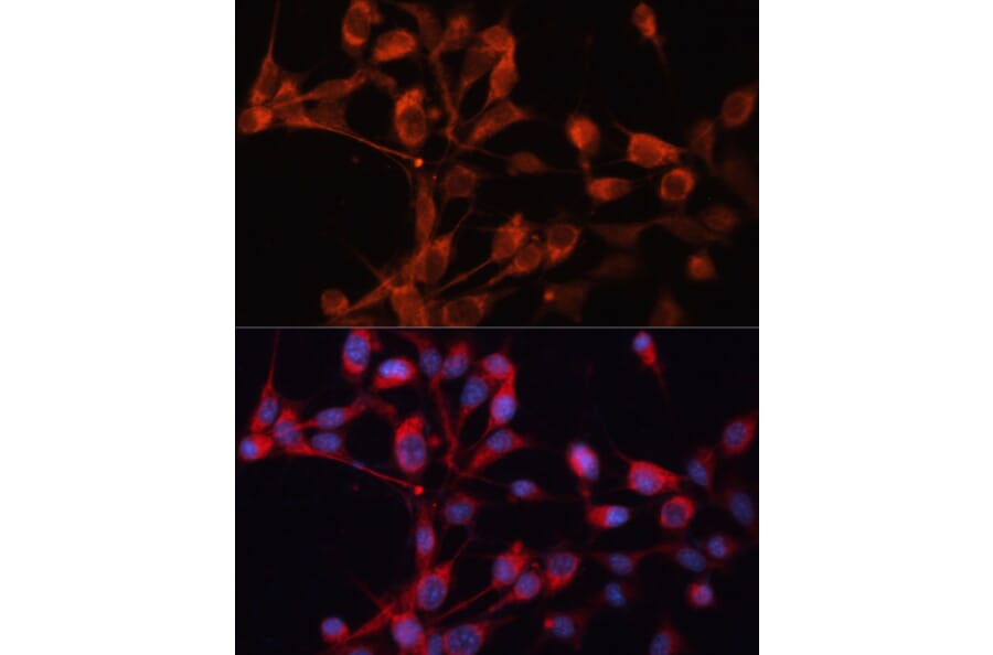 Immunofluorescence - Anti-SLC25A19 Antibody (A92178) - Antibodies.com
