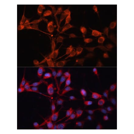 Immunofluorescence - Anti-SLC25A19 Antibody (A92178) - Antibodies.com