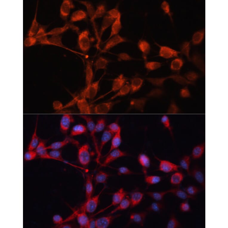 Immunofluorescence - Anti-SLC25A19 Antibody (A92178) - Antibodies.com