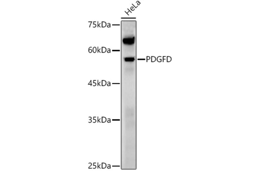 Western Blot - Anti-SCDGFB/PDGF-D Antibody (A92184) - Antibodies.com