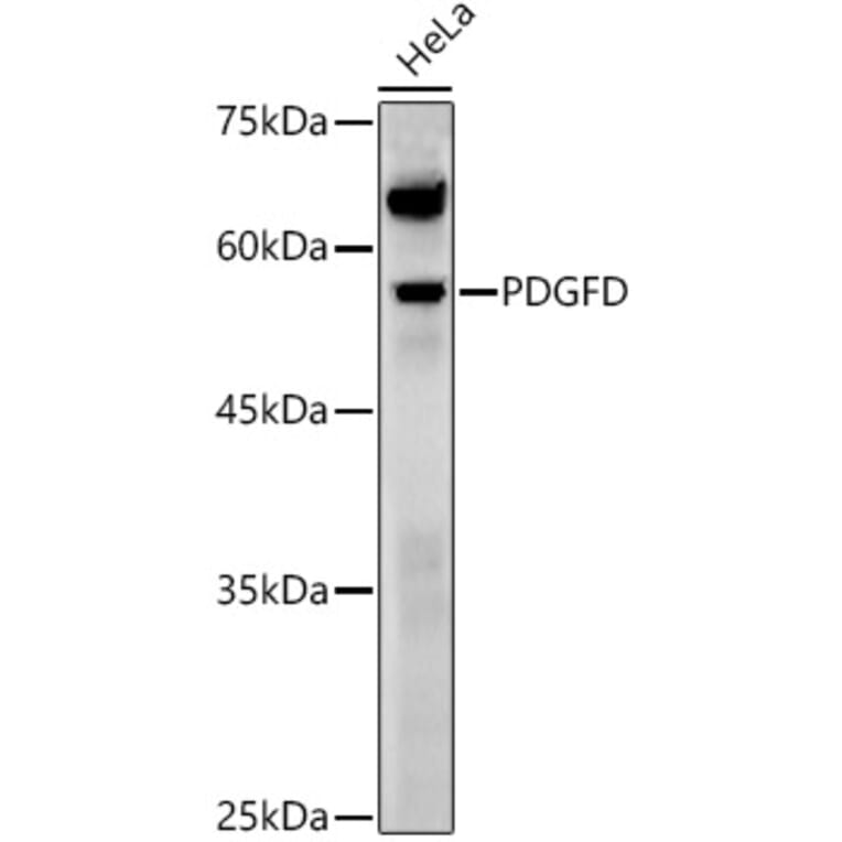 Western Blot - Anti-SCDGFB/PDGF-D Antibody (A92184) - Antibodies.com