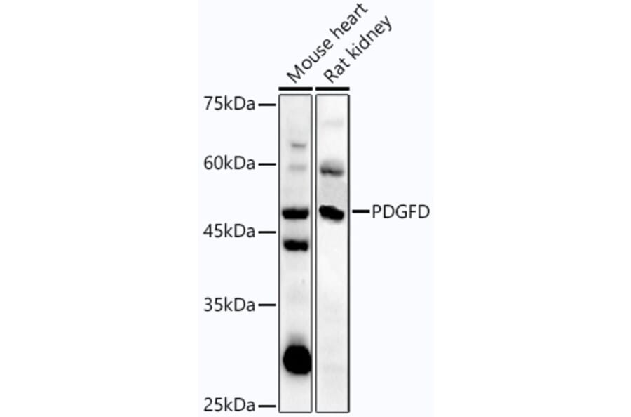 Western Blot - Anti-SCDGFB/PDGF-D Antibody (A92184) - Antibodies.com