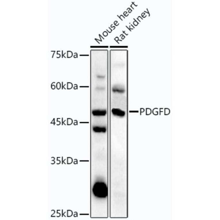 Western Blot - Anti-SCDGFB/PDGF-D Antibody (A92184) - Antibodies.com