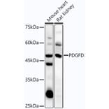 Western Blot - Anti-SCDGFB/PDGF-D Antibody (A92184) - Antibodies.com