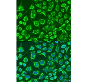 Immunofluorescence - Anti-GPB Antibody (A92190) - Antibodies.com