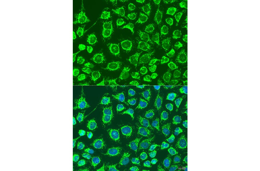 Immunofluorescence - Anti-GPB Antibody (A92190) - Antibodies.com