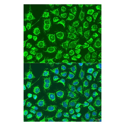 Immunofluorescence - Anti-GPB Antibody (A92190) - Antibodies.com
