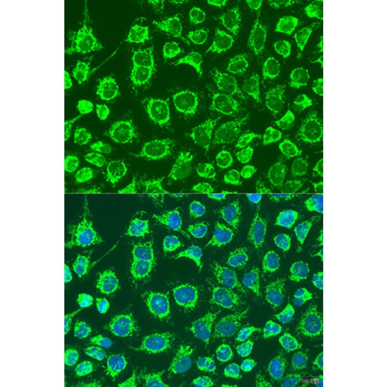 Immunofluorescence - Anti-GPB Antibody (A92190) - Antibodies.com