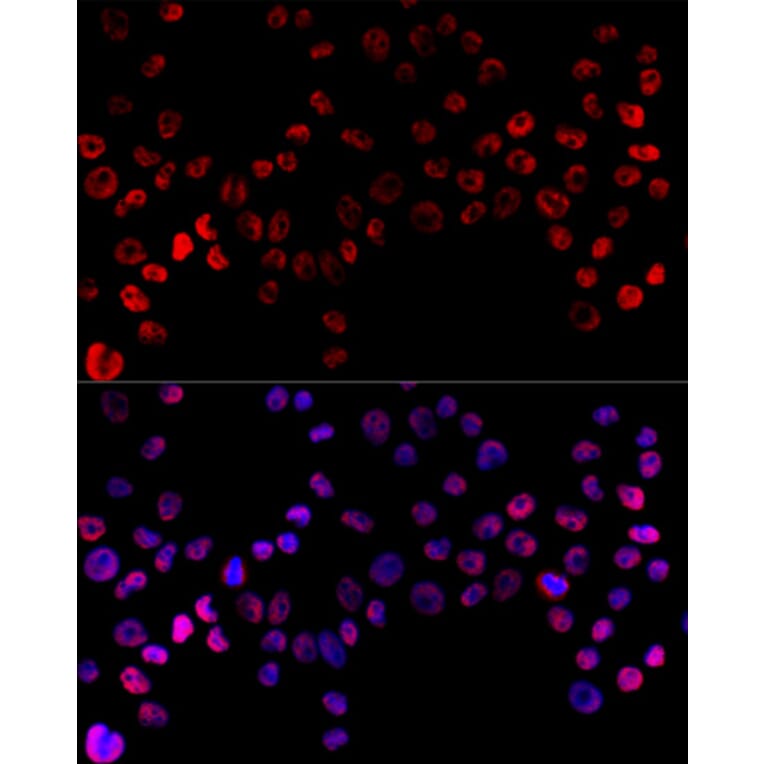 Immunofluorescence - Anti-HNRNPH1 Antibody (A15065) - Antibodies.com