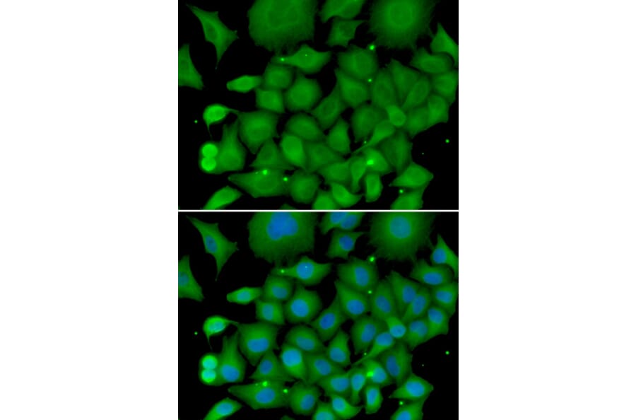 Immunofluorescence - Anti-SOD3 Antibody (A13935) - Antibodies.com