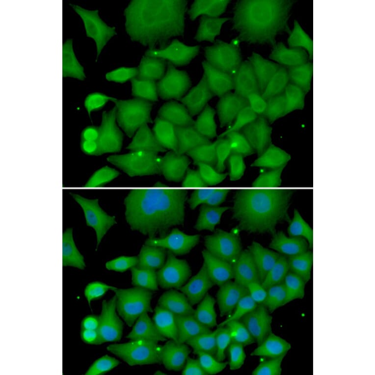 Immunofluorescence - Anti-SOD3 Antibody (A13935) - Antibodies.com