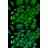 Immunofluorescence - Anti-SOD3 Antibody (A13935) - Antibodies.com