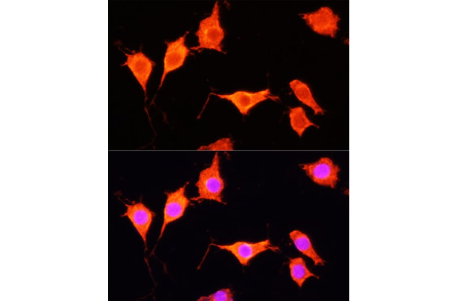 Immunofluorescence - Anti-SOD3 Antibody (A13935) - Antibodies.com