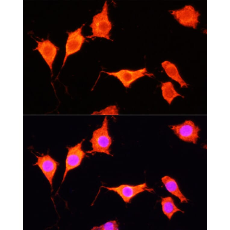 Immunofluorescence - Anti-SOD3 Antibody (A13935) - Antibodies.com