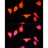 Immunofluorescence - Anti-SOD3 Antibody (A13935) - Antibodies.com