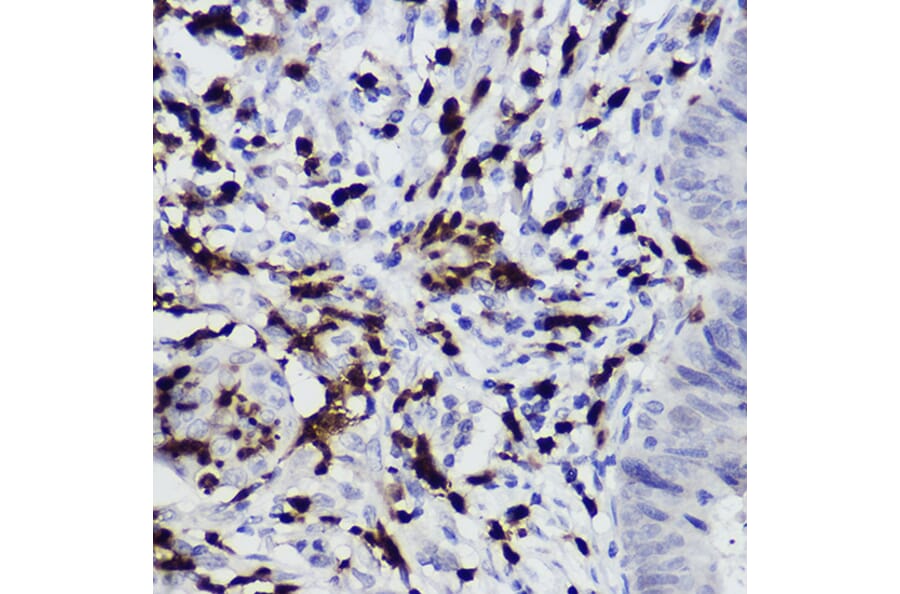 Immunohistochemistry - Anti-S100A12 Antibody (A92195) - Antibodies.com