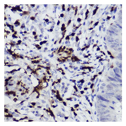 Immunohistochemistry - Anti-S100A12 Antibody (A92195) - Antibodies.com