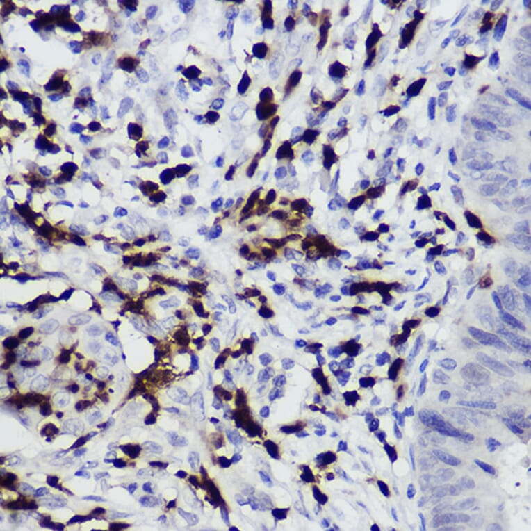 Immunohistochemistry - Anti-S100A12 Antibody (A92195) - Antibodies.com