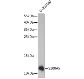 Western Blot - Anti-S100A5 Antibody (A92196) - Antibodies.com