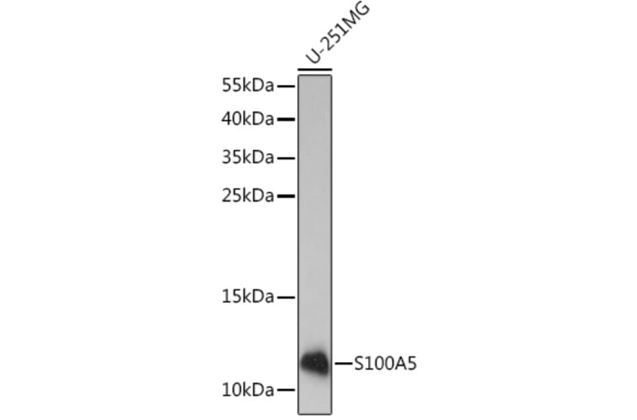 Western Blot - Anti-S100A5 Antibody (A92196) - Antibodies.com