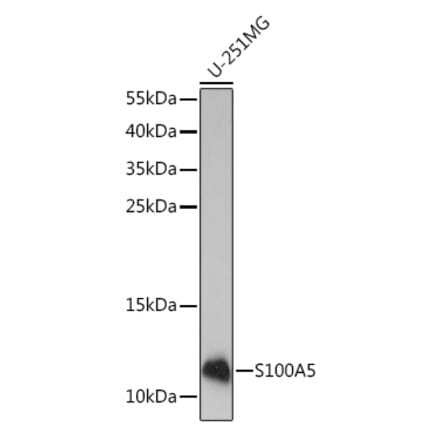 Western Blot - Anti-S100A5 Antibody (A92196) - Antibodies.com