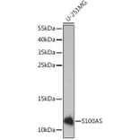 Western Blot - Anti-S100A5 Antibody (A92196) - Antibodies.com