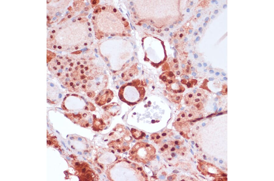 Immunohistochemistry - Anti-S100A5 Antibody (A92196) - Antibodies.com
