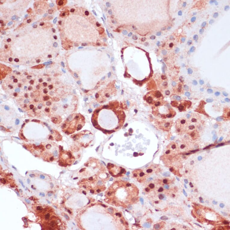 Immunohistochemistry - Anti-S100A5 Antibody (A92196) - Antibodies.com