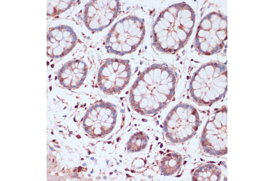 Immunohistochemistry - Anti-S100A5 Antibody (A92196) - Antibodies.com