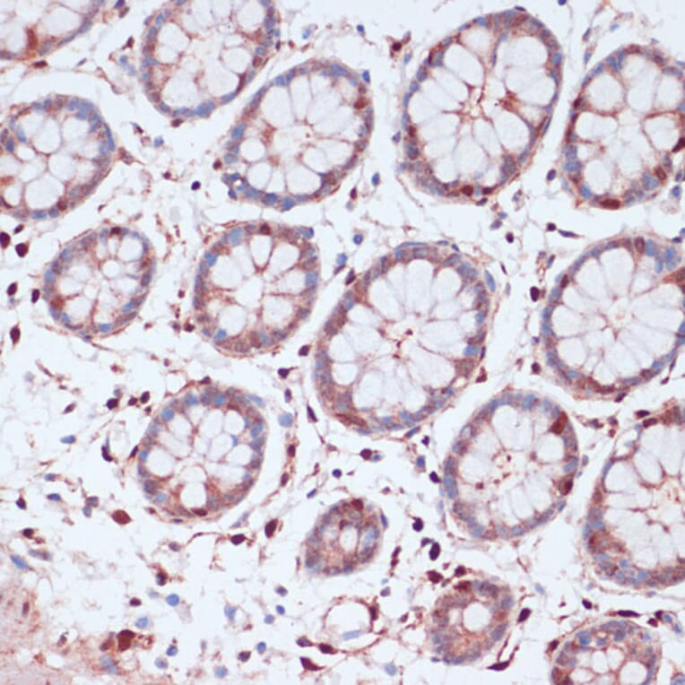 Immunohistochemistry - Anti-S100A5 Antibody (A92196) - Antibodies.com