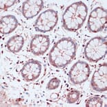 Immunohistochemistry - Anti-S100A5 Antibody (A92196) - Antibodies.com