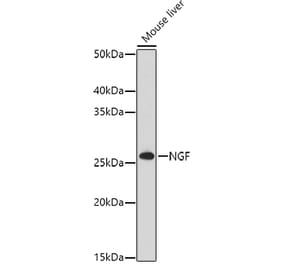 Western Blot - Anti-NGF Antibody (A92198) - Antibodies.com
