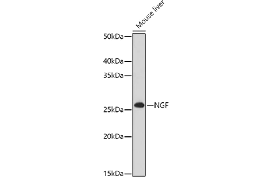 Western Blot - Anti-NGF Antibody (A92198) - Antibodies.com