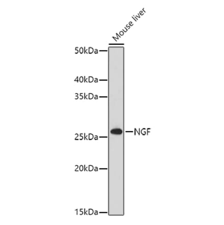 Western Blot - Anti-NGF Antibody (A92198) - Antibodies.com