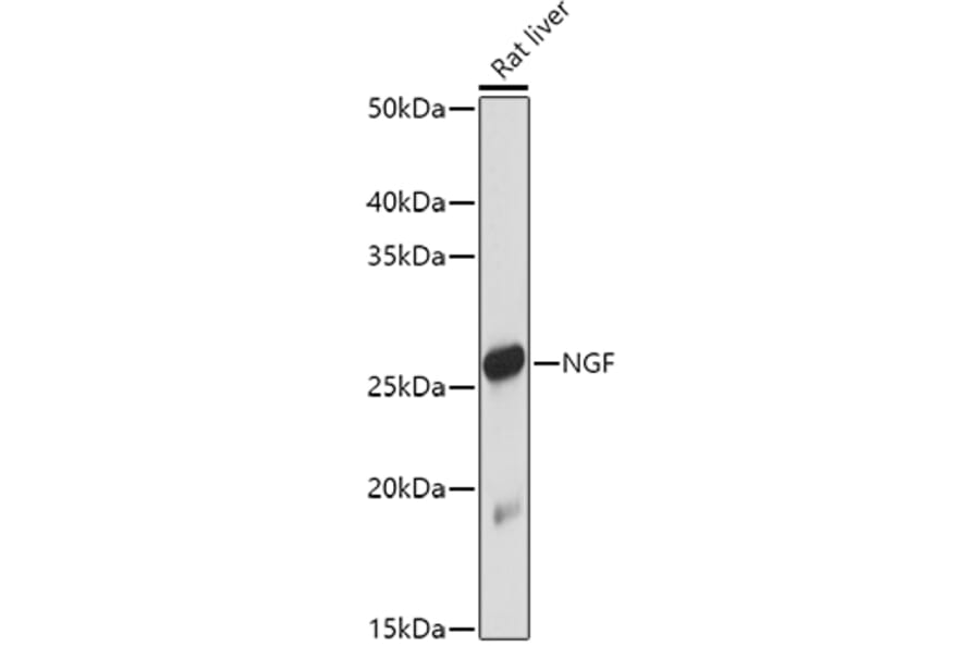 Western Blot - Anti-NGF Antibody (A92198) - Antibodies.com